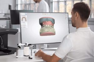Denturist Digital Solution with 3D Printer